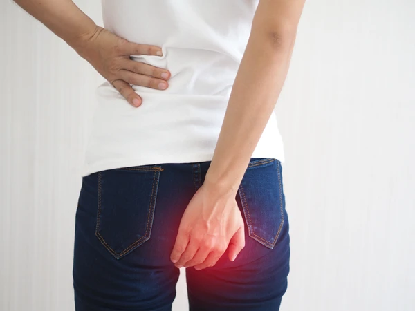 5 Obat Wasir Herbal Terbaik untuk Mengatasi Ambeien Secara Alami